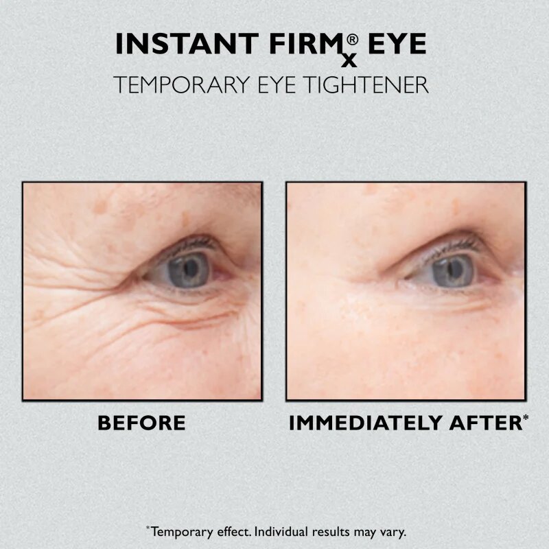 Peter Thomas Roth Instant FIRMx Eye szemkrém a bőr fiatalításáért 30 ml