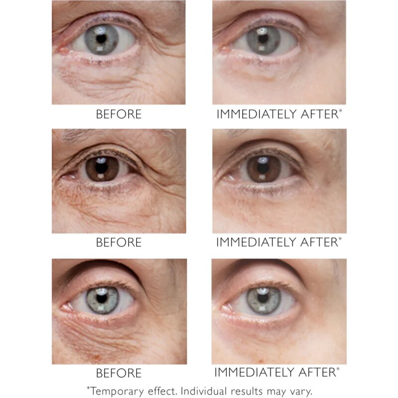 Peter Thomas Roth Instant FIRMx Eye szemkrém a bőr fiatalításáért 30 ml