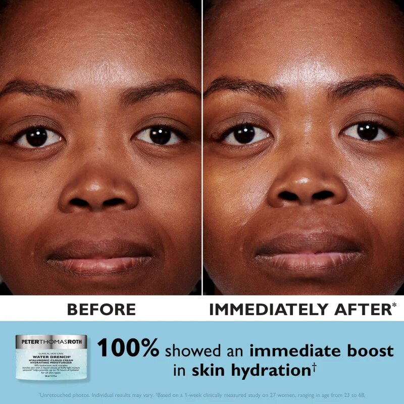 Peter Thomas Roth Water Drench Mini Day & Night Cloud Creams ajándékszett az intenzív hidratálásért