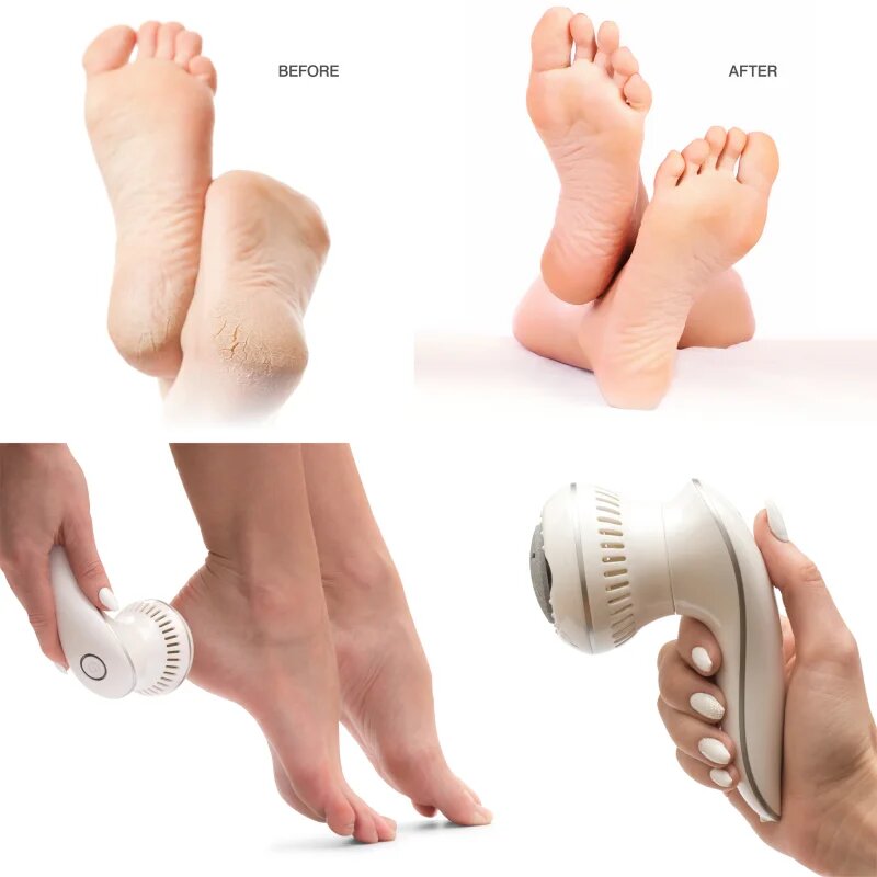 RIO 60 Second Spa Pedi 3 bőrkeményedés-eltávolító 1 db