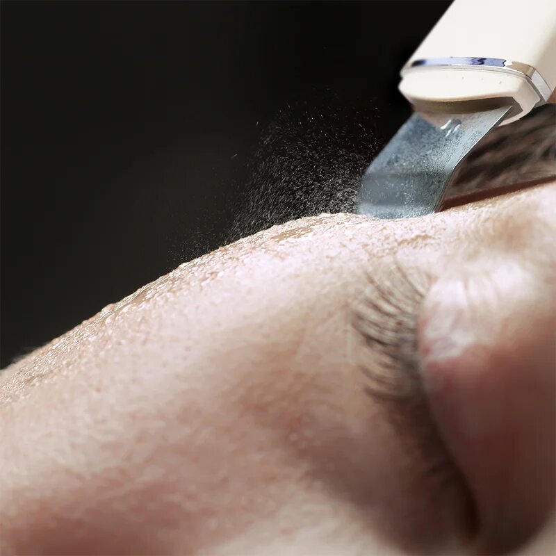 RIO Ultrasonic Skin Cleanser multifunkciós ultrahangos spatula 1 db