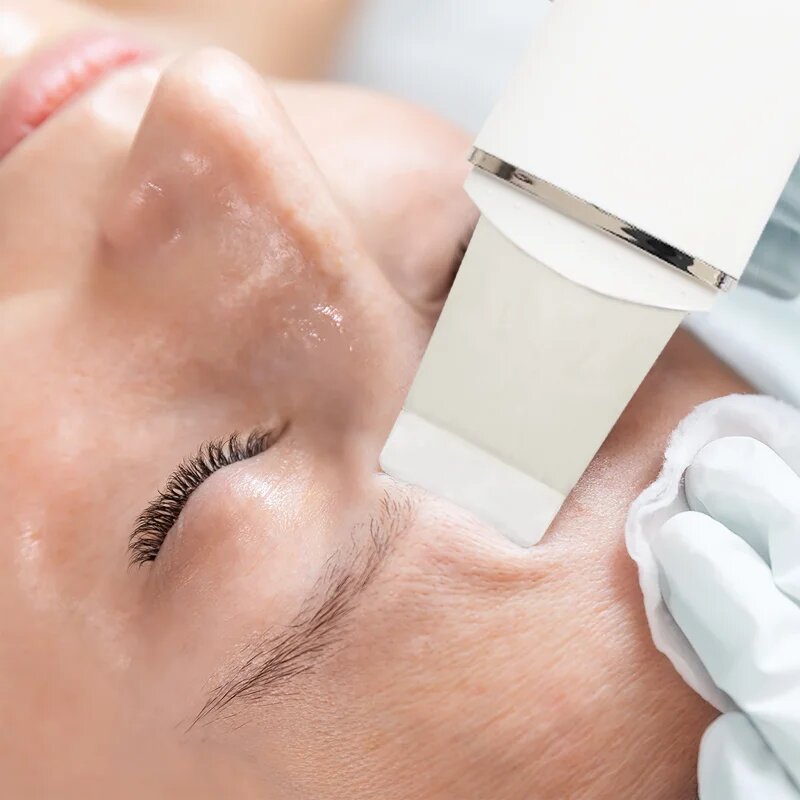 RIO Ultrasonic Skin Cleanser multifunkciós ultrahangos spatula 1 db