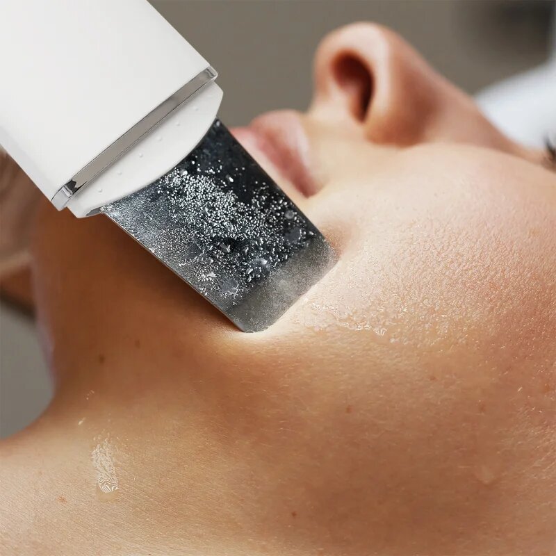 RIO Ultrasonic Skin Cleanser multifunkciós ultrahangos spatula 1 db