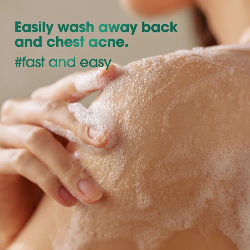 Some By Mi AHA∙BHA∙PHA 30 Days Miracle Acne Clear Body Cleanser habos tisztító gél 400 g