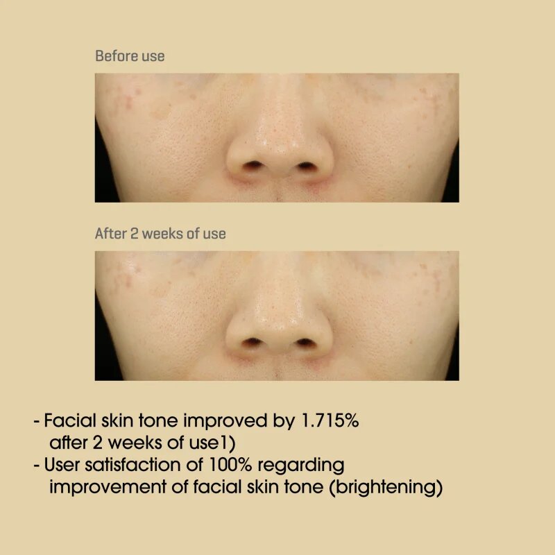 Some By Mi Yuja Niacin 30 Days Miracle Brightening Toner élénkítő tonik 150 ml
