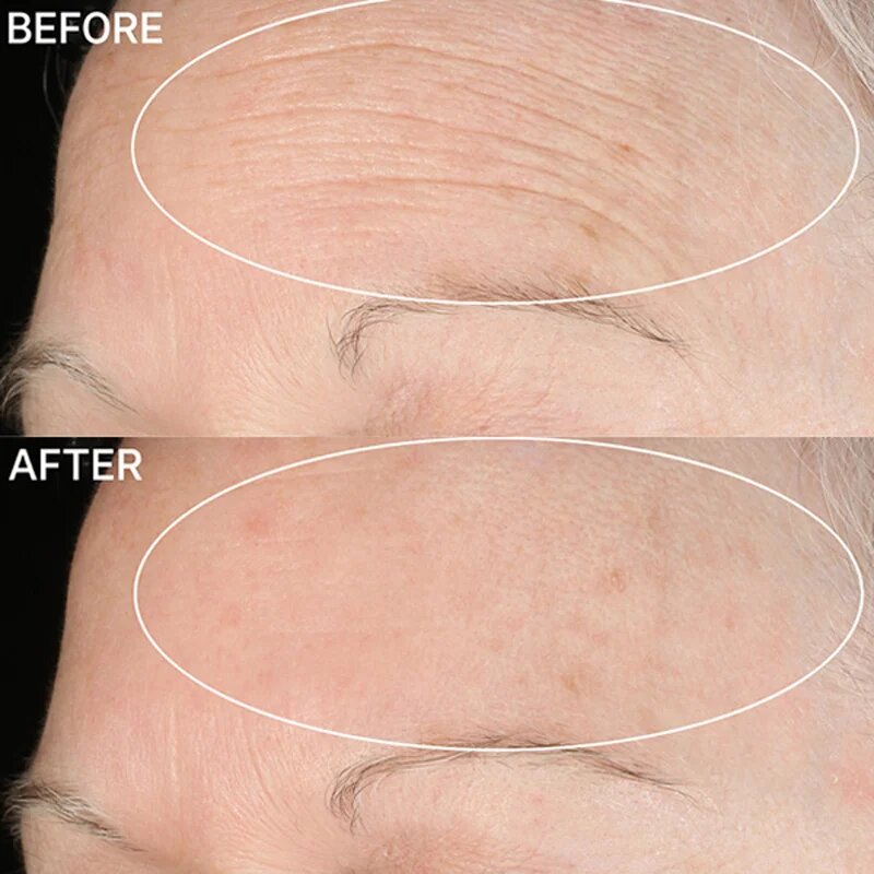 StriVectin Anti-Wrinkle SD Advanced Plus koncentrált ránctalanító krém 118 ml