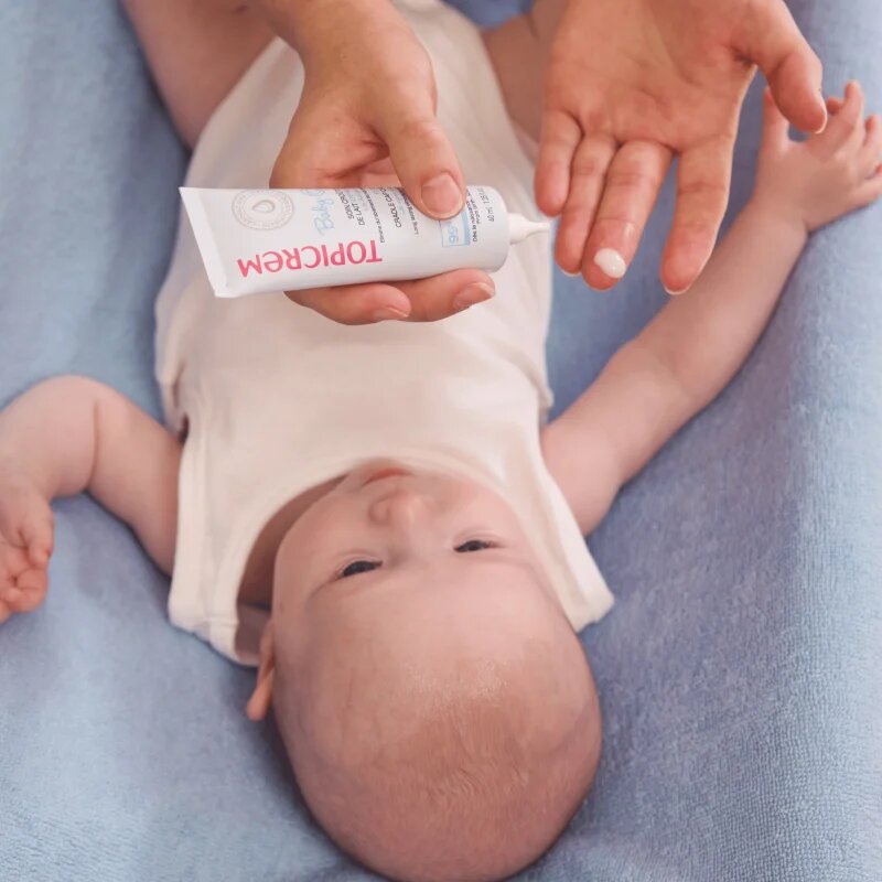 Topicrem BABY Cradle Cap Care gél koszmóra gyermekeknek születéstől kezdődően 40 ml