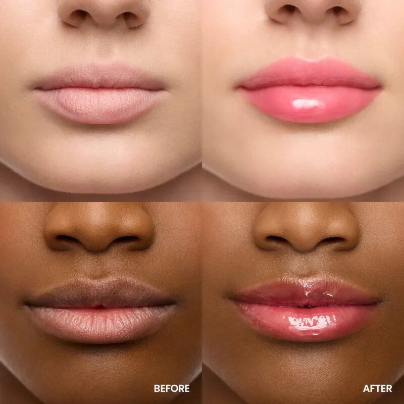 WONDERSKIN Lip Rehab Serum Oil ajak olaj árnyalat amour 3.57 ml