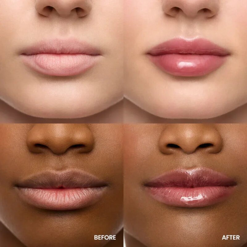 WONDERSKIN Lip Rehab Serum Oil ajak olaj árnyalat Honey 3.57 ml