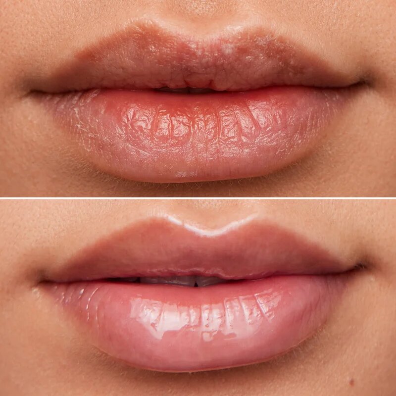 WONDERSKIN Lip Rehab Therapy Oil ajak olaj hidratáló hatással árnyalat Clear 357 ml